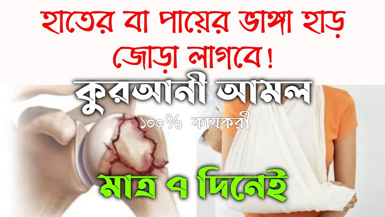 ভাঙ্গা হাড় জোড়া লাগানোর দোয়া আমল উপায় | হাত পা ভেঙ্গে গেলে জোড়া লাগানোর আমল দোয়া |hat pa venge