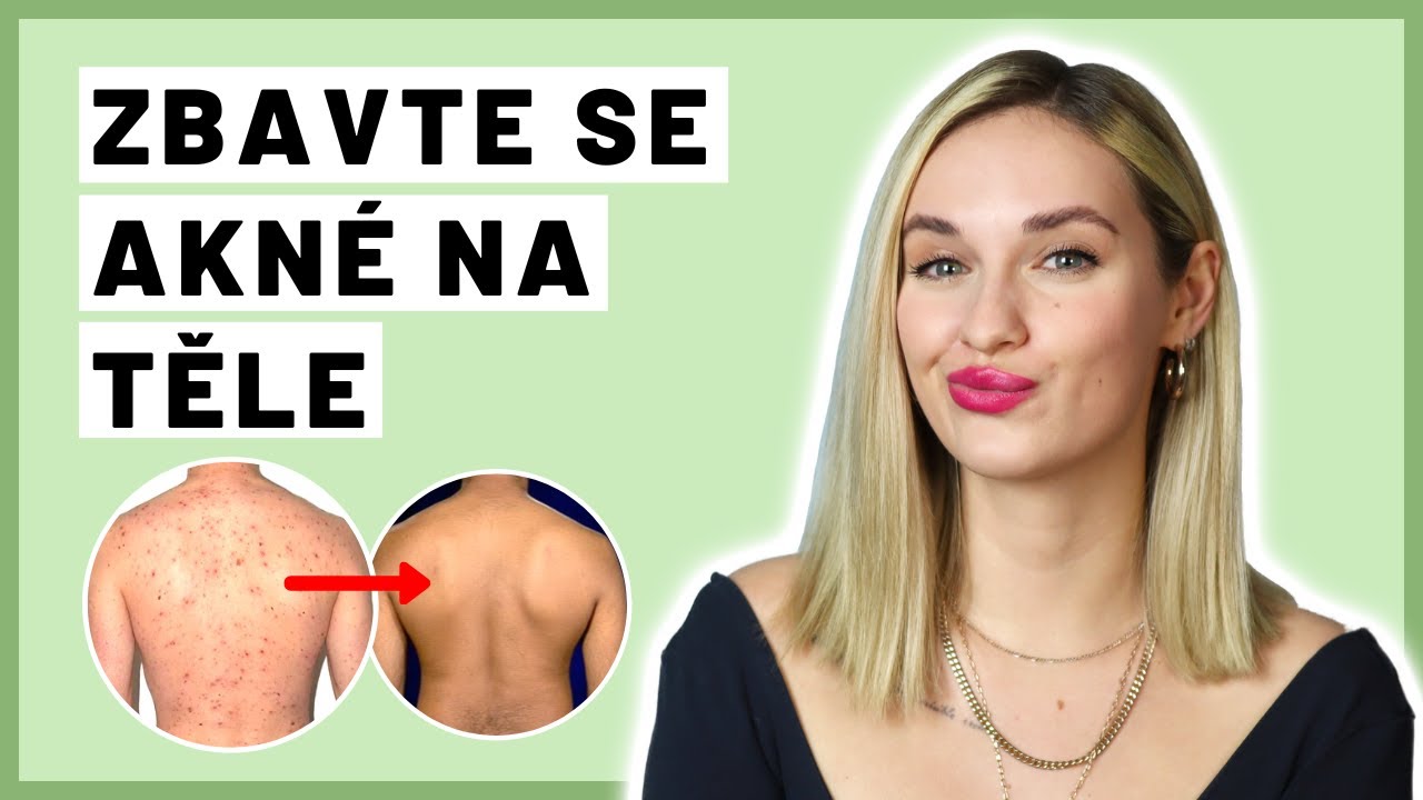 Jak se zbavit akné na těle | KOMPLETNÍ NÁVOD