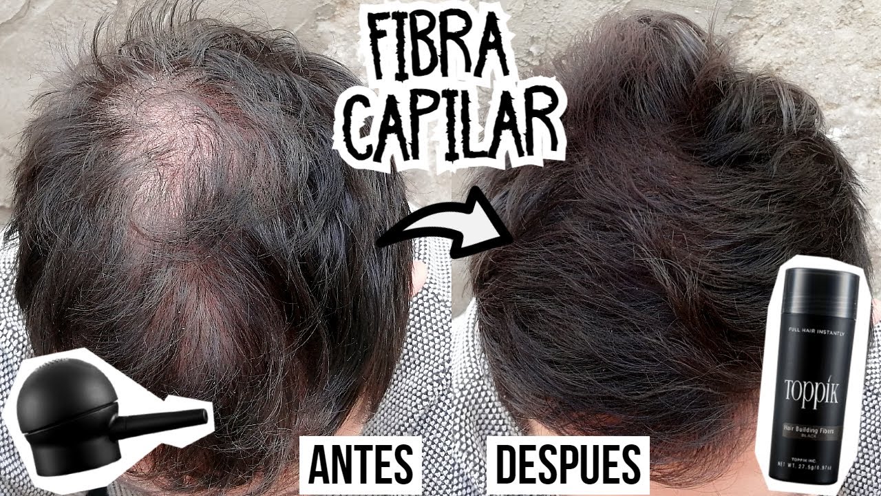 Como Usar FIBRA CAPILAR en el CABELLO para Ocultar CALVICIE | Toppik Alopecia