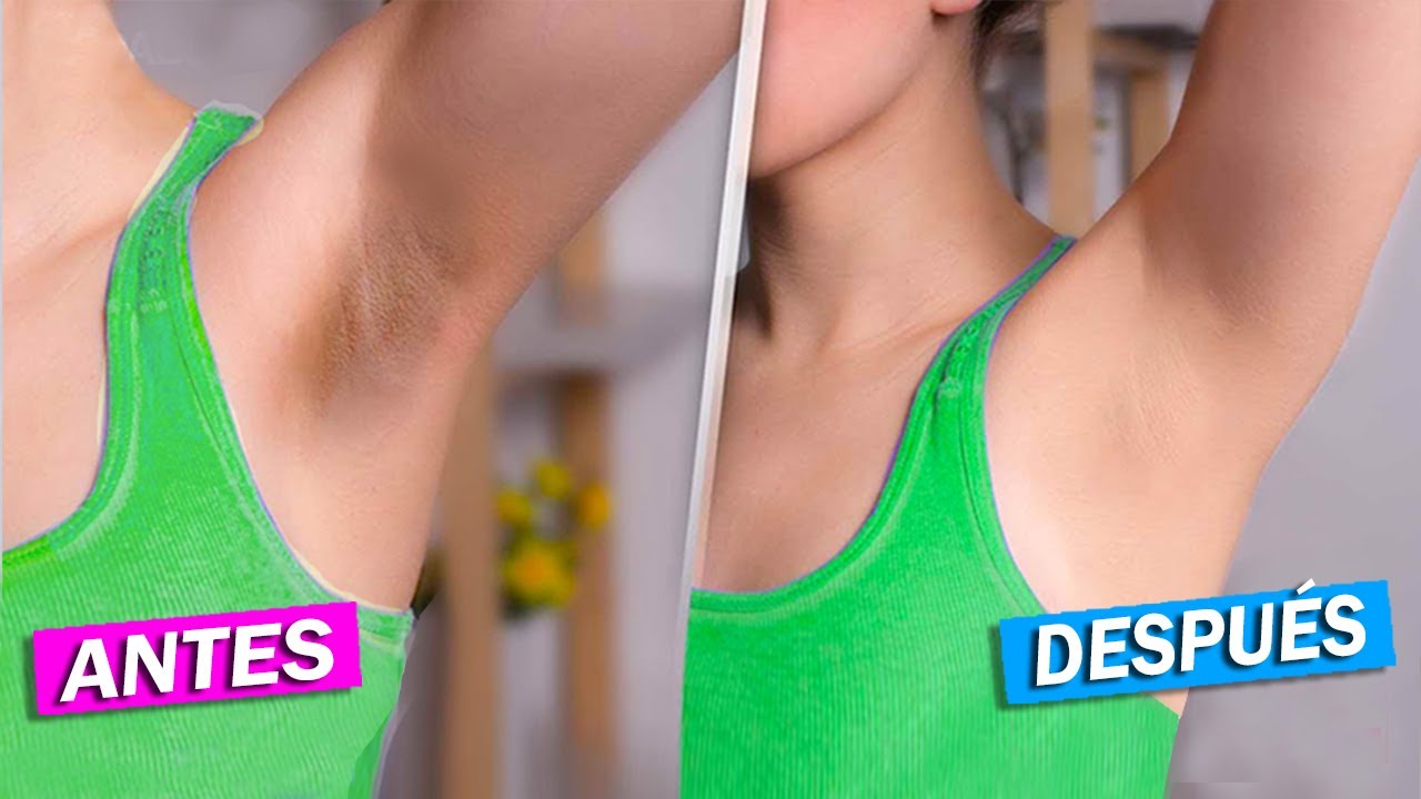 C&Oacute;MO ACLARAR AXILAS en 7 D&Iacute;AS SI LAS TIENES OSCURAS (REMEDIO 100% NATURAL)