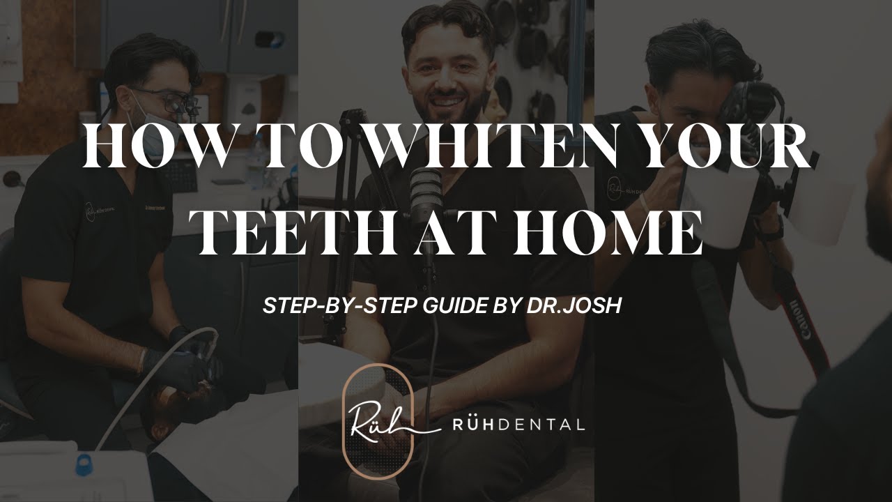 How to Use Your Dentist-Approved Teeth Whitening Kit at Home | Step-by-Step Guide by Dr. Josh