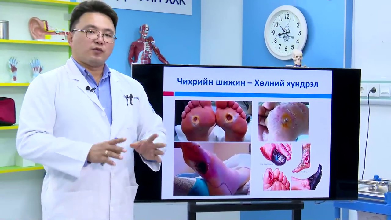 С тасаг- Чихрийн шижин