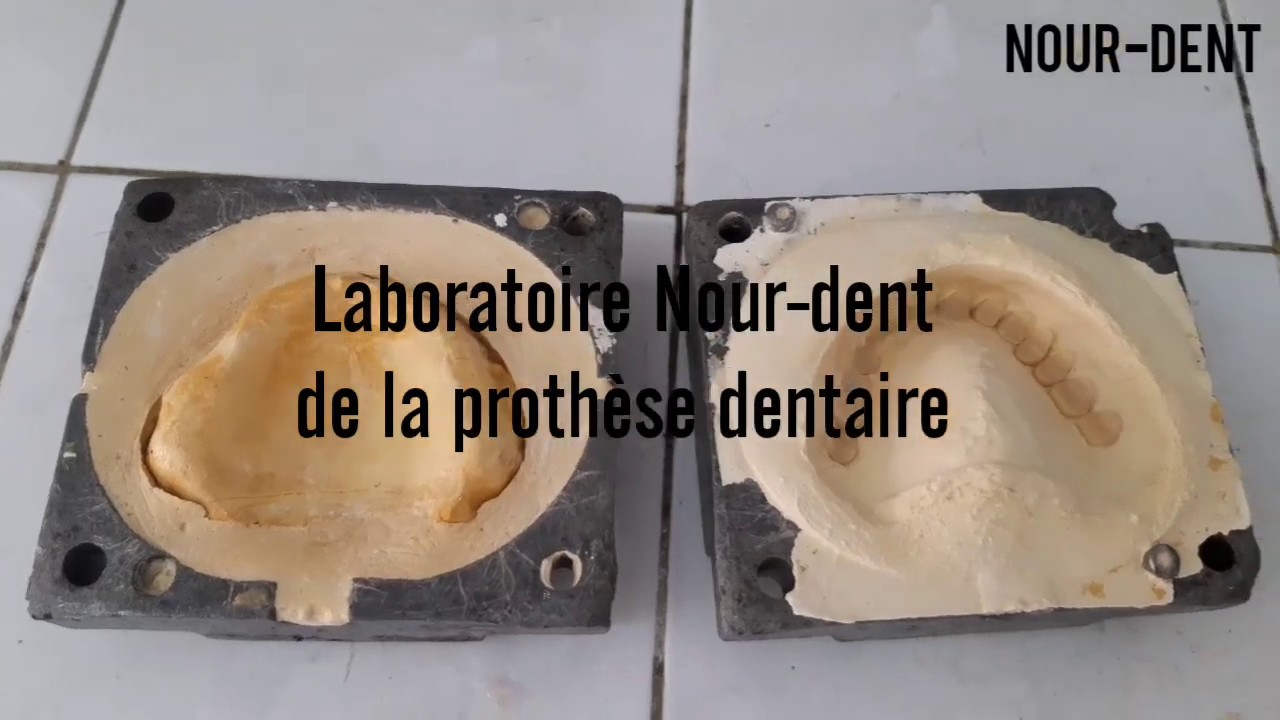 Mise en moufle d'un valplast total haut et bas (1ère partie).