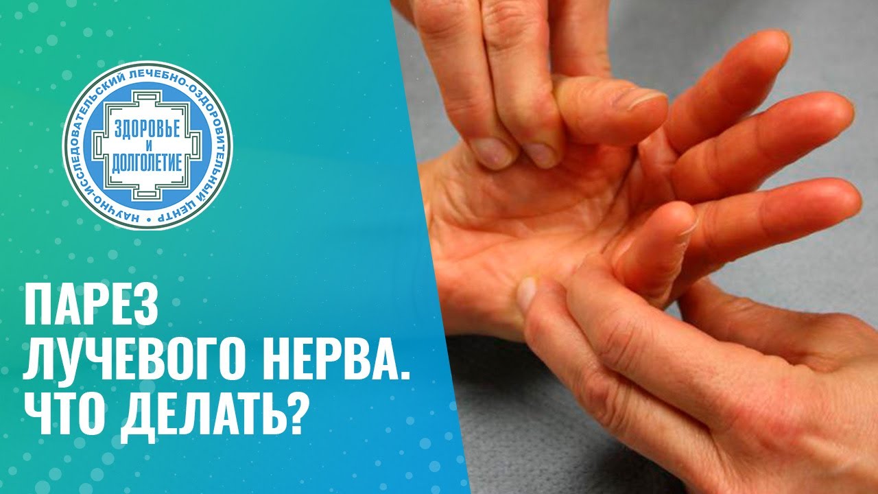 🤏 Парез лучевого нерва. Что делать?