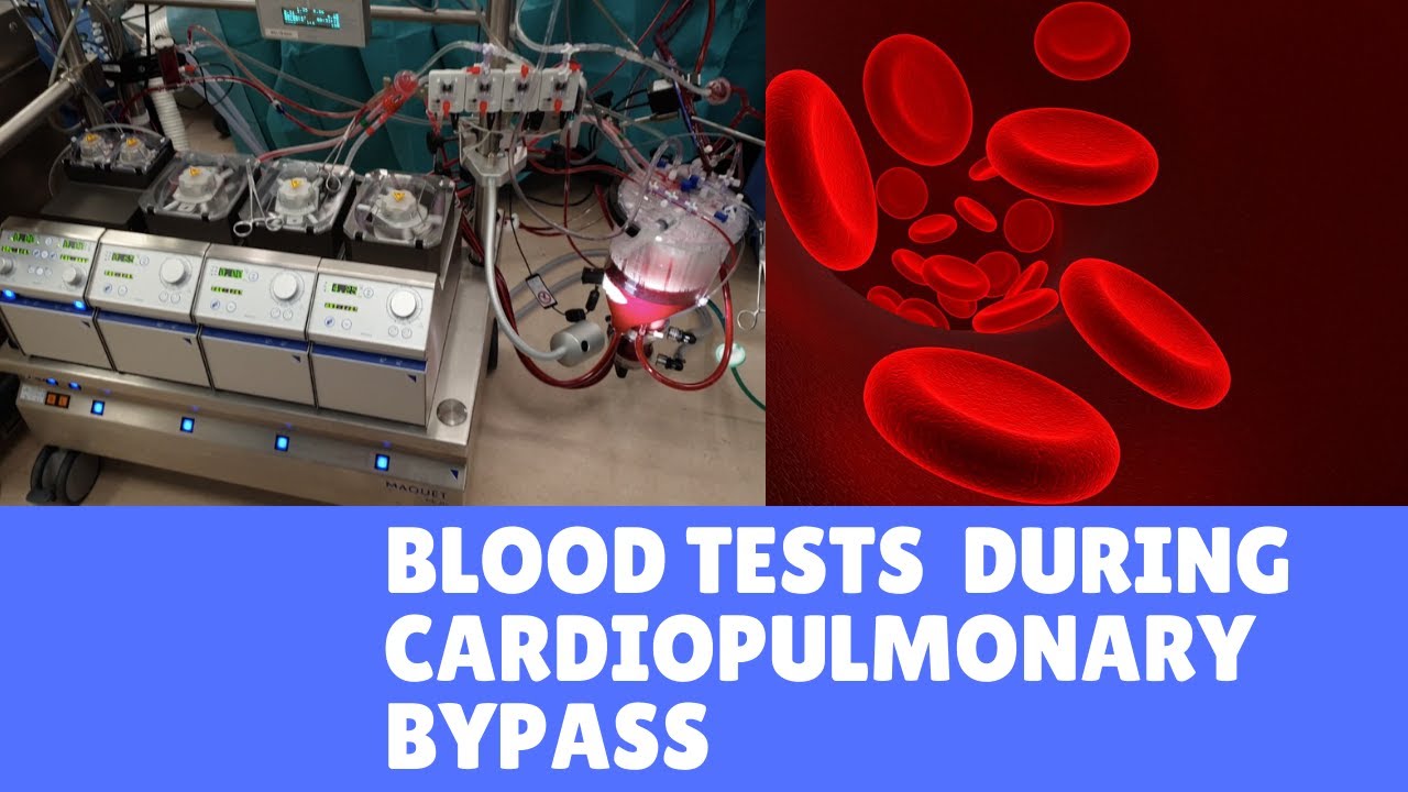 Blood Tests during Cardiopulmonary Bypass