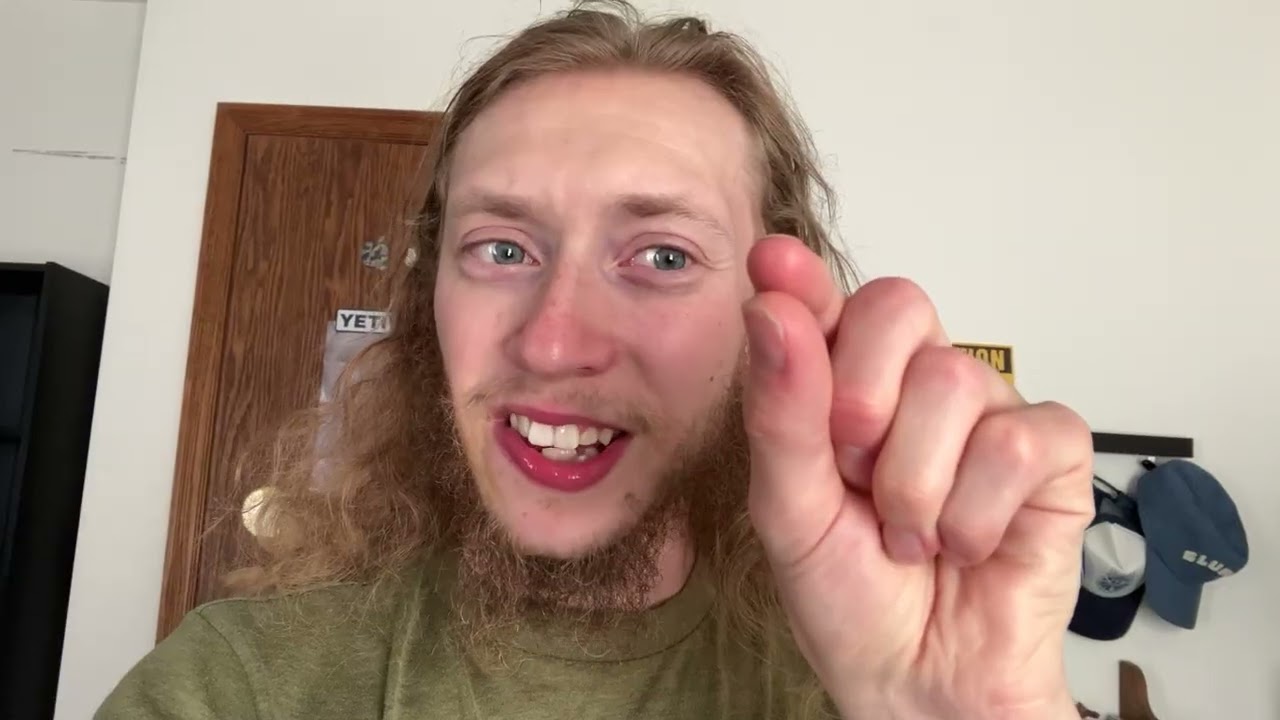 26 months of patchy beard growth/Two years and two months