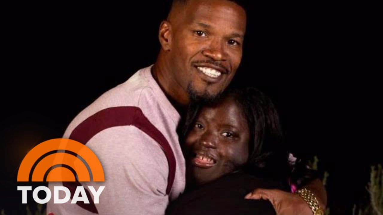 Jamie Foxx ‘Learned How To Live’ From Younger Sister With Down Syndrome | TODAY