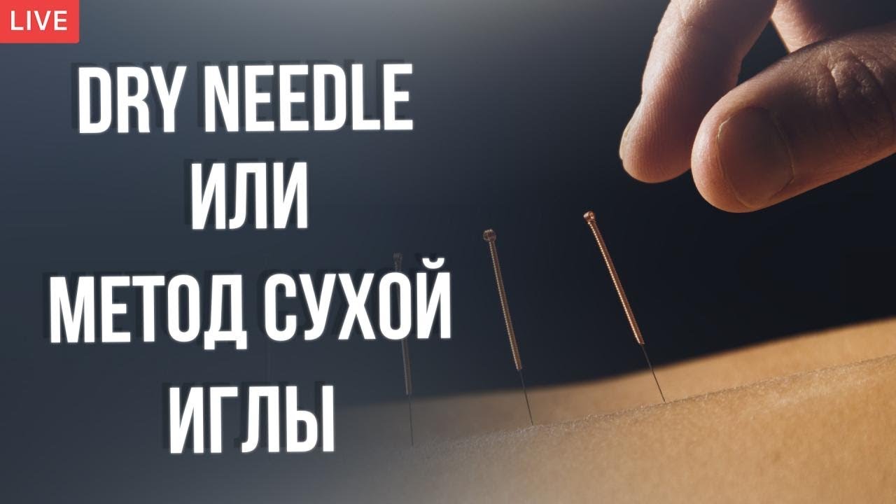 Иглоукалывание (Иглотерапия) или Метод Сухой Иглы.