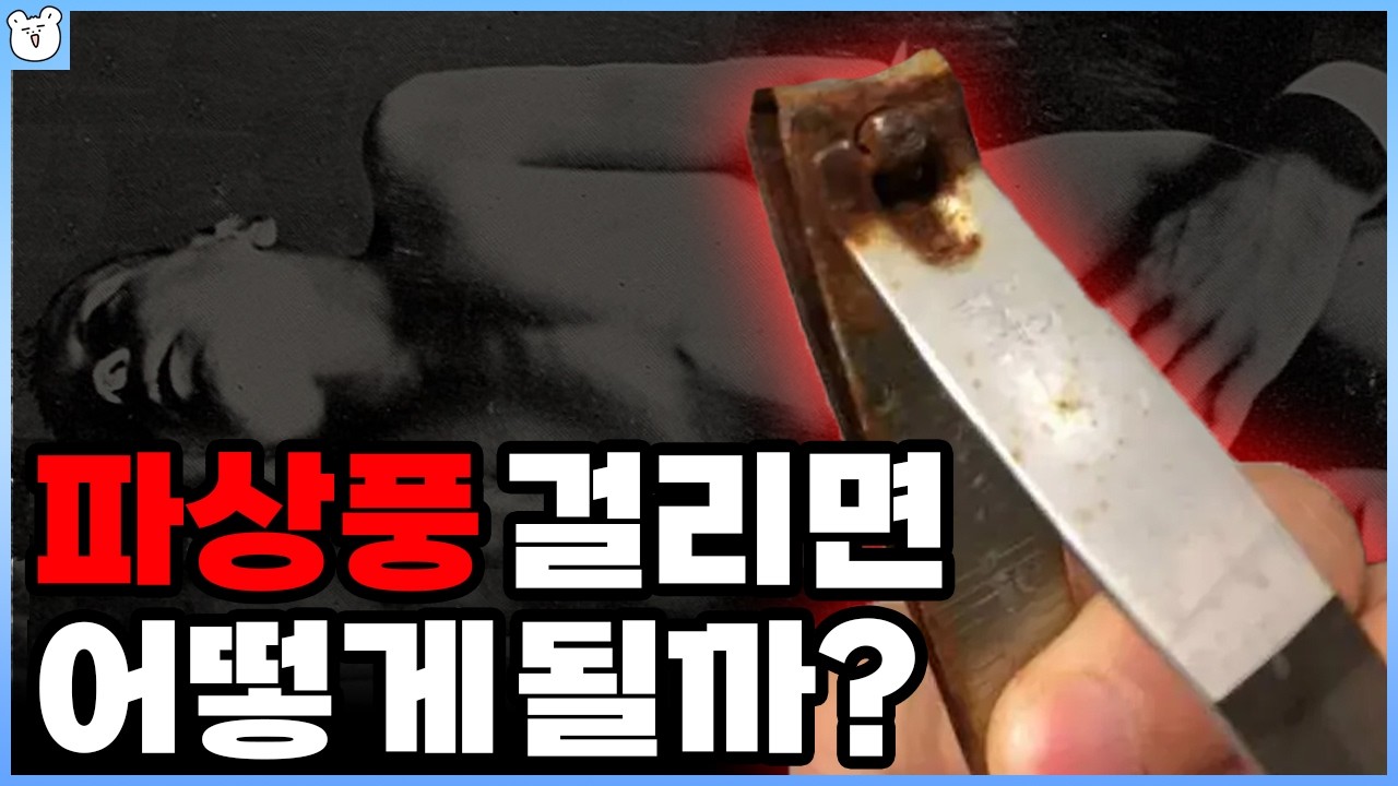 파상풍이 이렇게 무서운 병이라고?