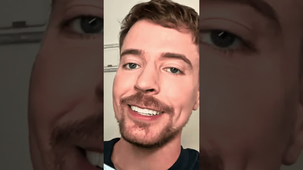 3D Printed Veneers Teeth