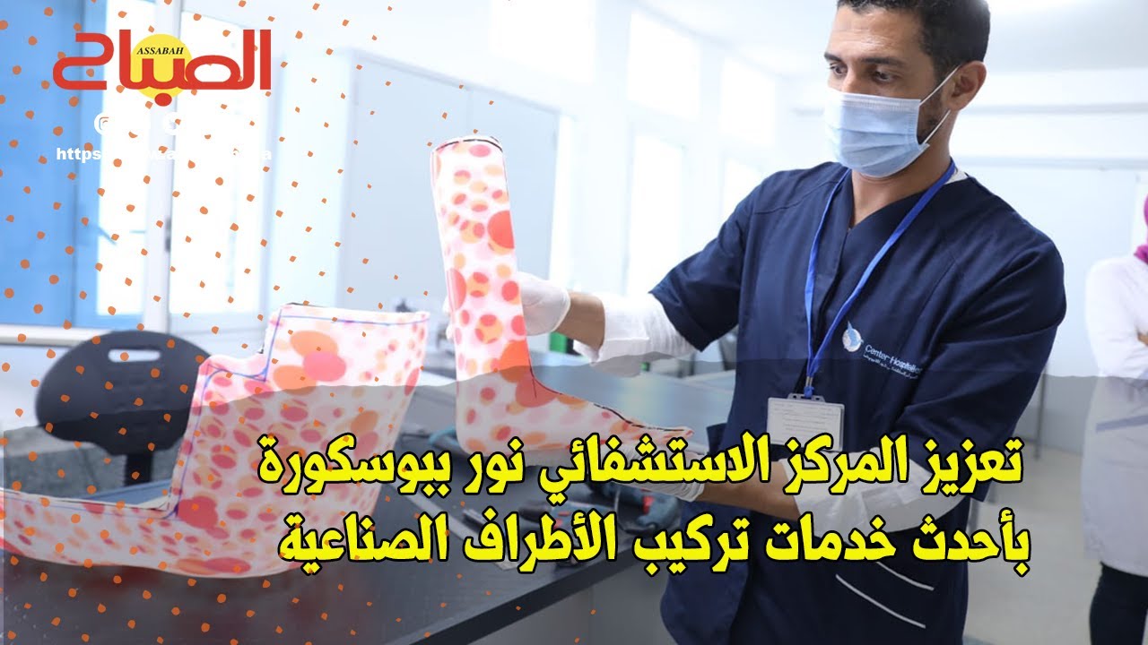 بوسكورة ... تعزيز المركز الاستشفائي نور بأحدث خدمات تركيب الأطراف الاصطناعية