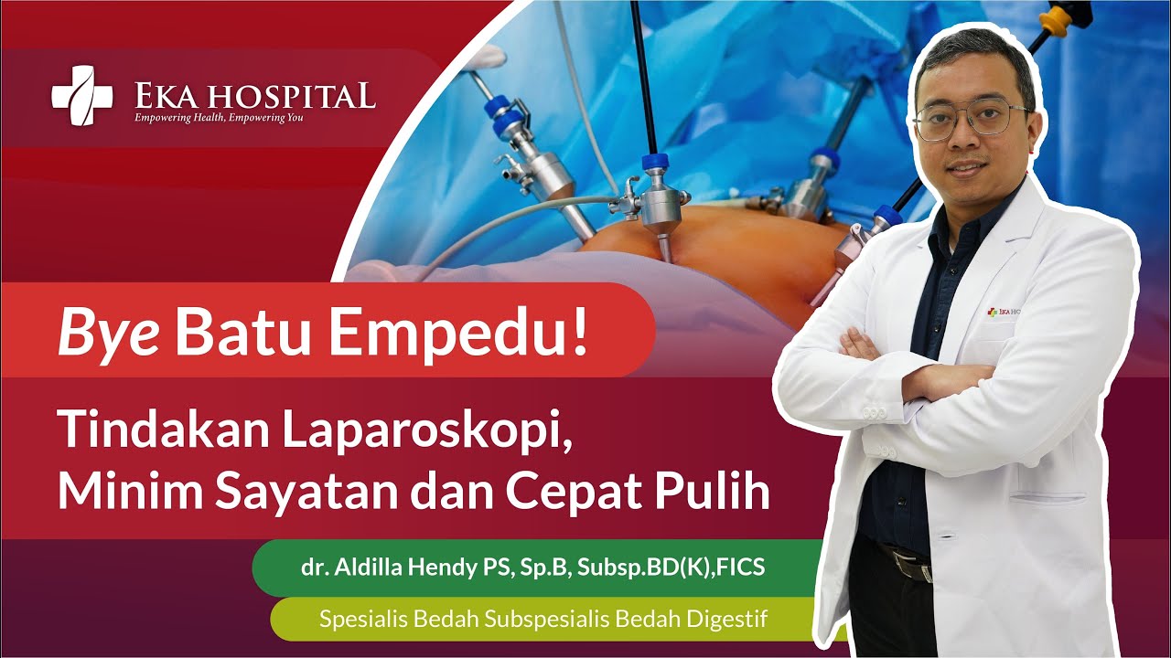 Minim Sayatan! Laparoskopi Solusi Batu Empedu. Kapan Harus Dioperasi?