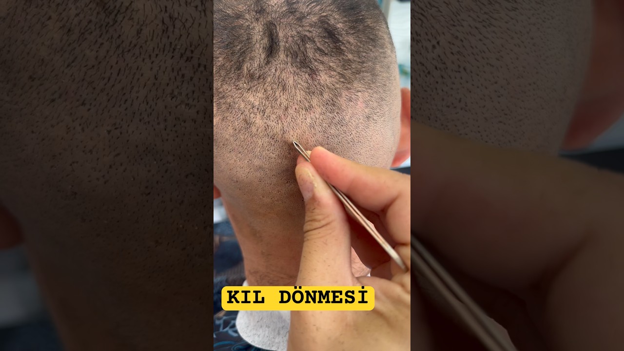 KIL D&Ouml;NMESİ ENSE #shortsvideo #like #youtubeshorts #india #kill #shortsvideo #like #tiktok #keşfet