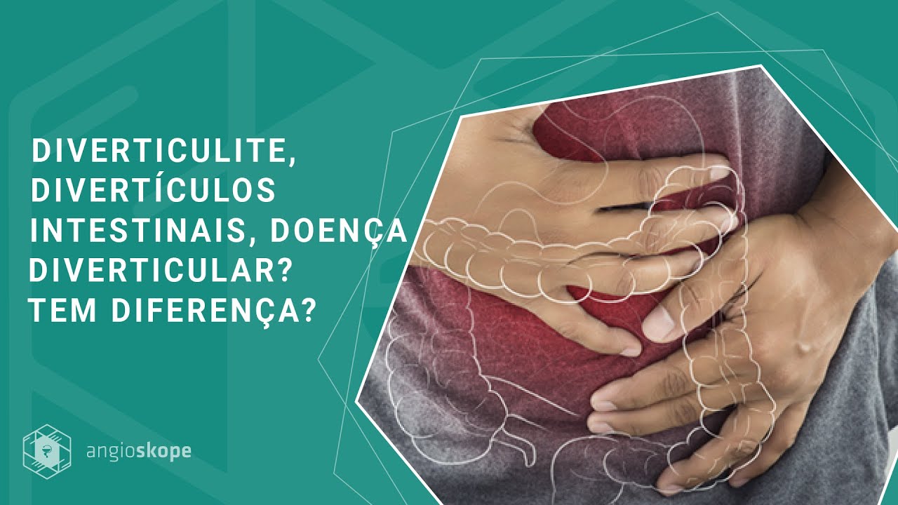 Diverticulite, divert&iacute;culos intestinais, doen&ccedil;a diverticular? Tem diferen&ccedil;a?