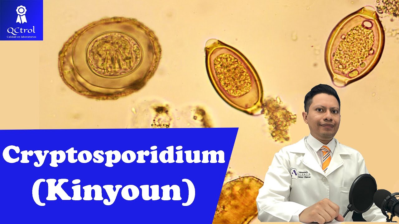 Знакомьтесь: Криптоспоридий: Морфология и КЛЮЧИ для его идентификации🔬