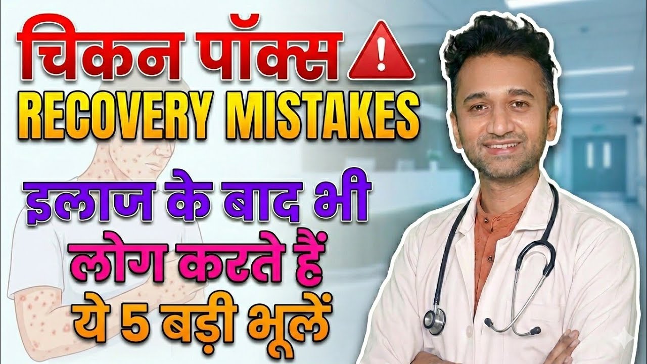 Chicken Pox Recovery Mistakes: इलाज के बाद भी लोग करते हैं ये बड़ी भूलें