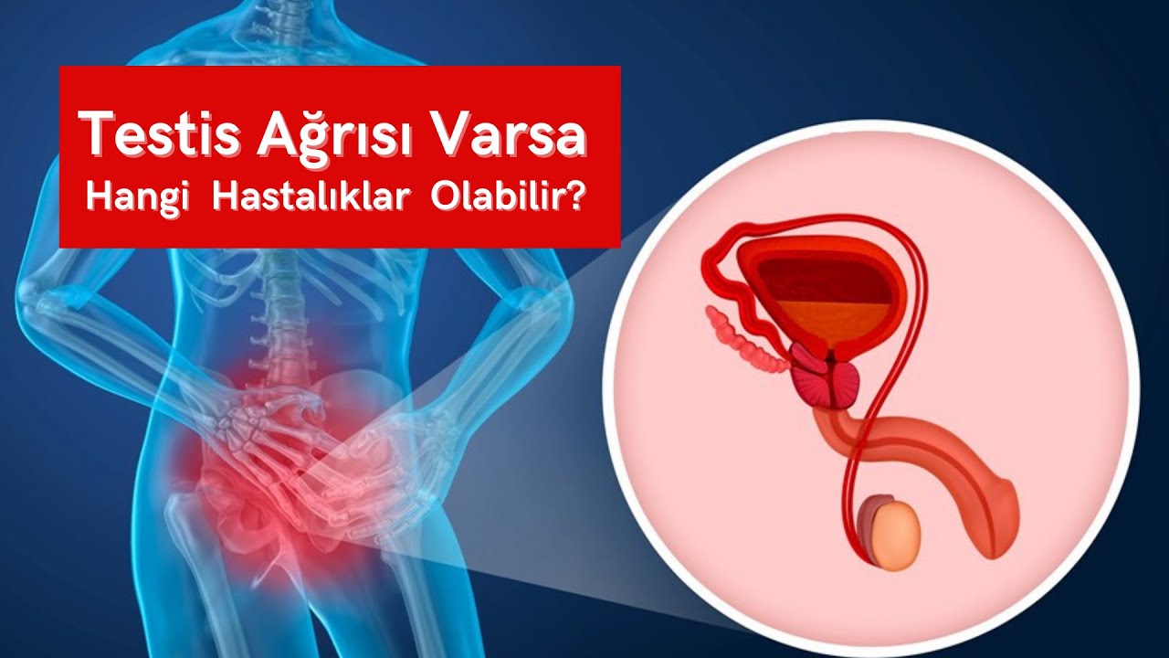 Testis Ağrısı Varsa Hangi Hastalıklar Olabilir?