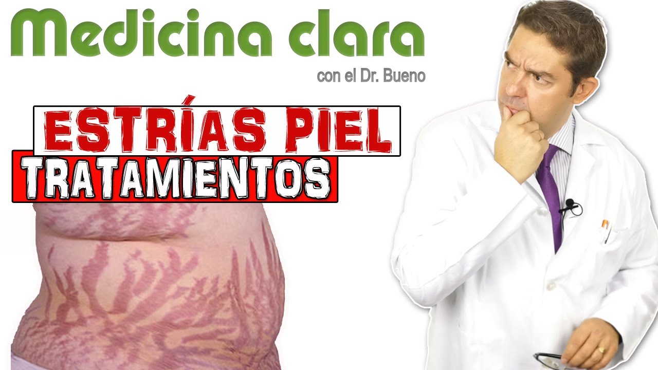 ESTRÍAS | ¿CUÁL es el MEJOR TRATAMIENTO para su ELIMINACIÓN? | Medicina Clara