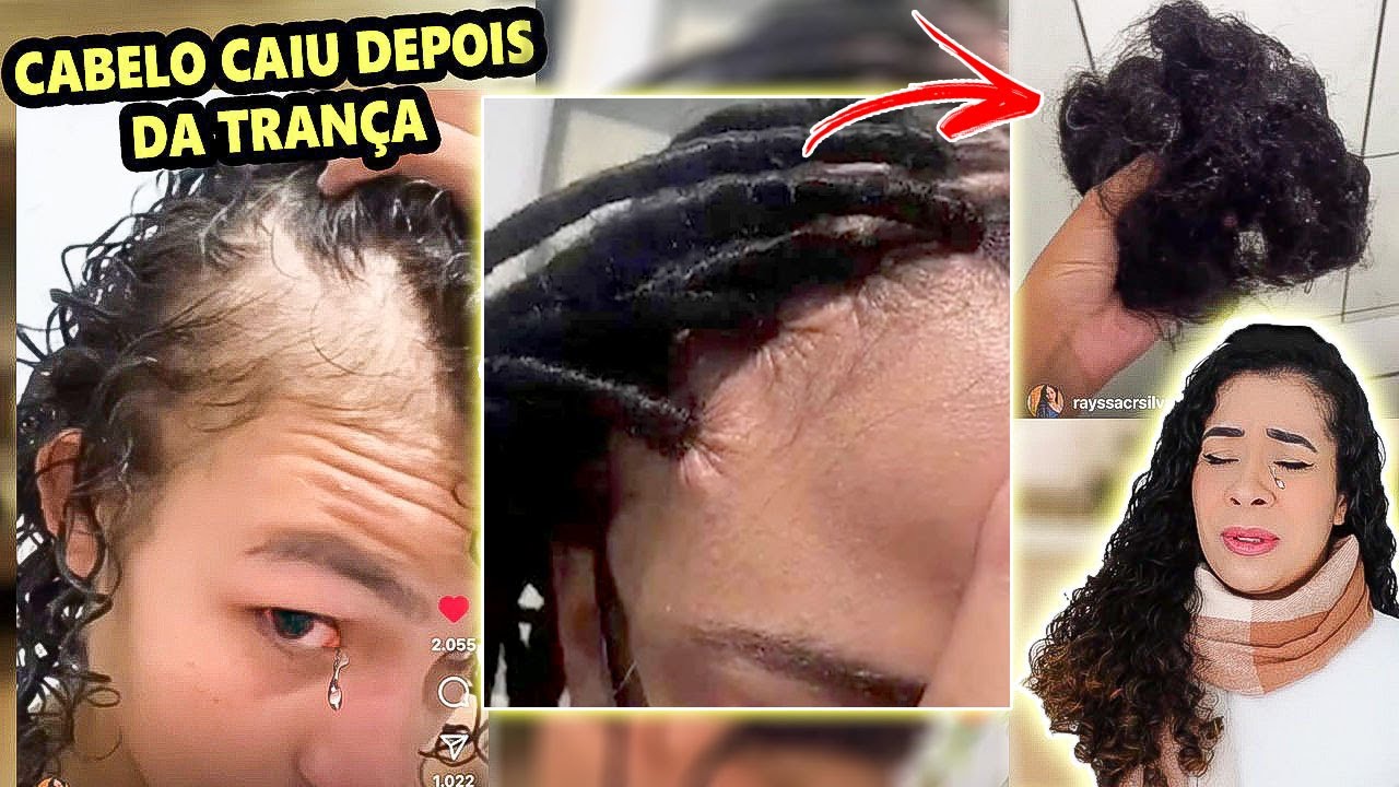 PERDEU TODO CABELO DEPOIS DAS TRANÇAS !!! CHOCANTE
