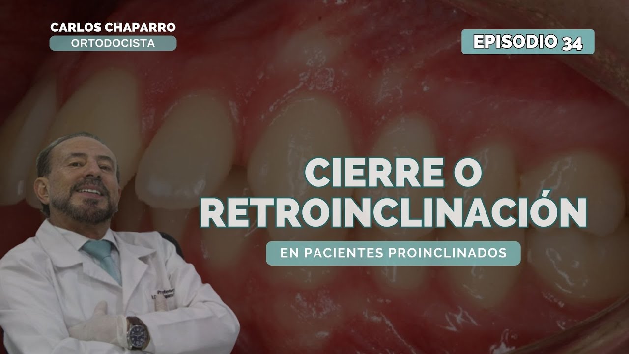 🦷 Cierre o Retroinclinación 🦷- Episodio 35