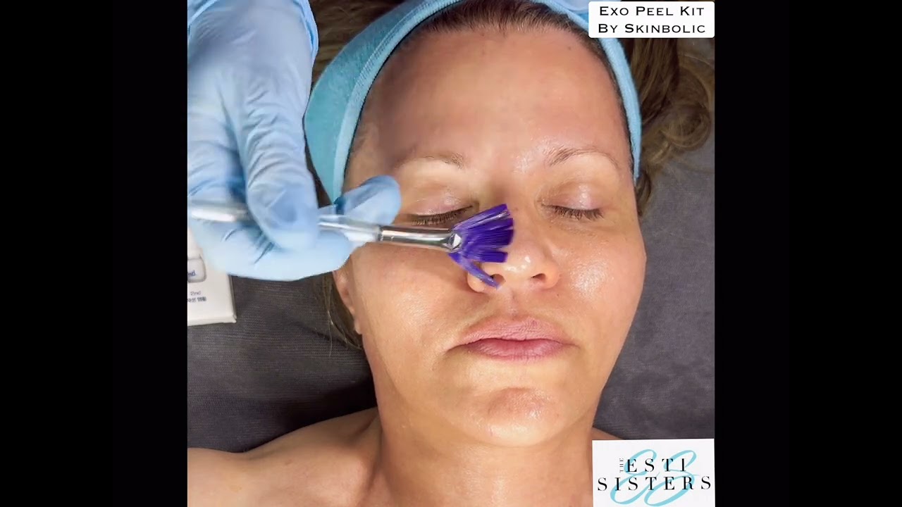 Exo Peel Kit Demo-Korean Exosomes Treatment