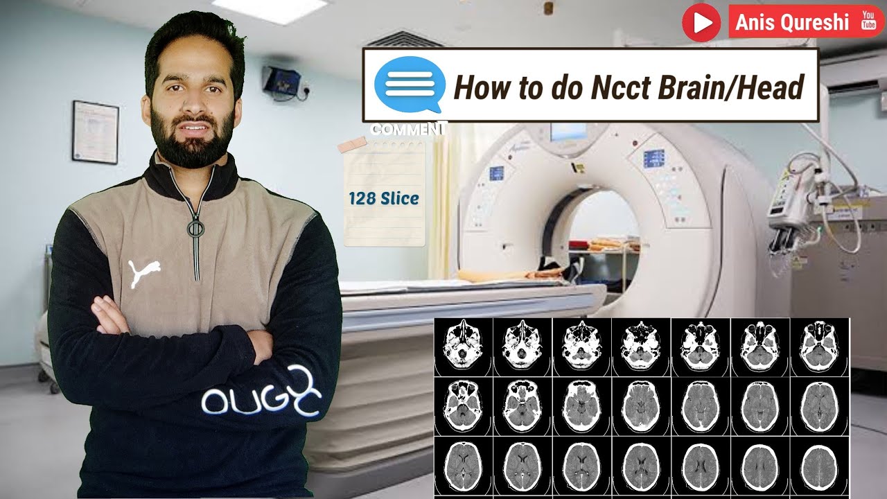 NCCT Brain/Head,128 Slice | By Anis Qureshi