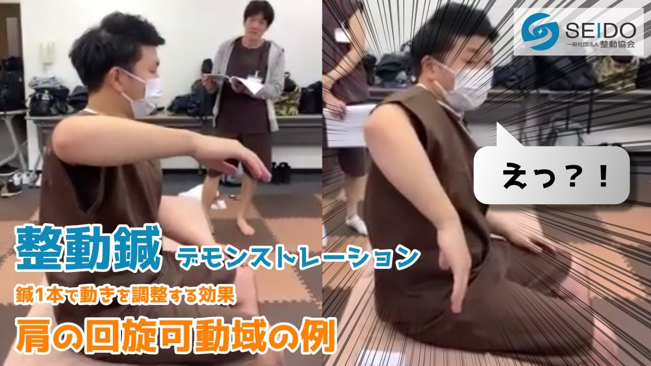 【整動鍼セミナーの一幕】鍼1本で動きを調整する効果―肩の回旋可動域の例