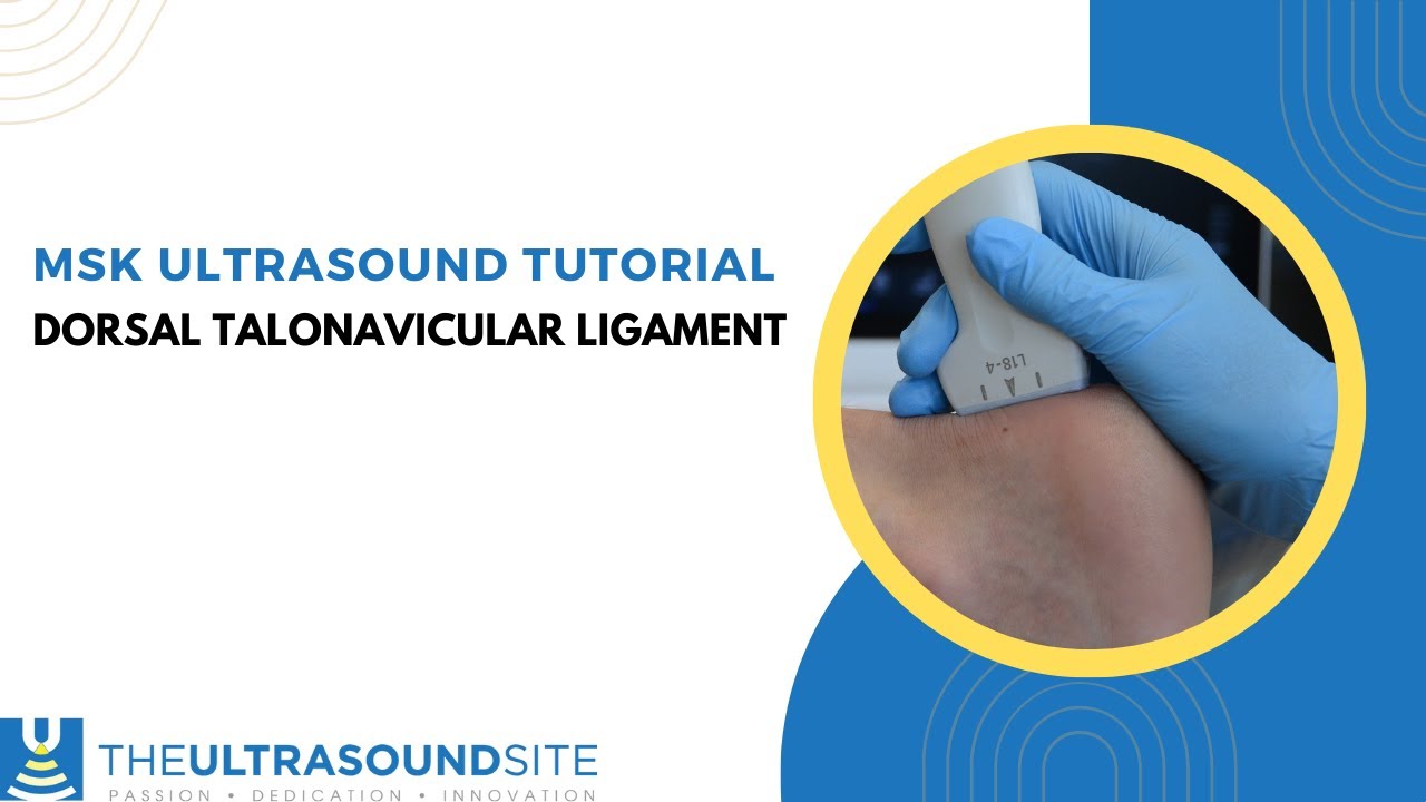 How to evaluate the midfoot for the dorsal talonavicular ligament on ultrasound