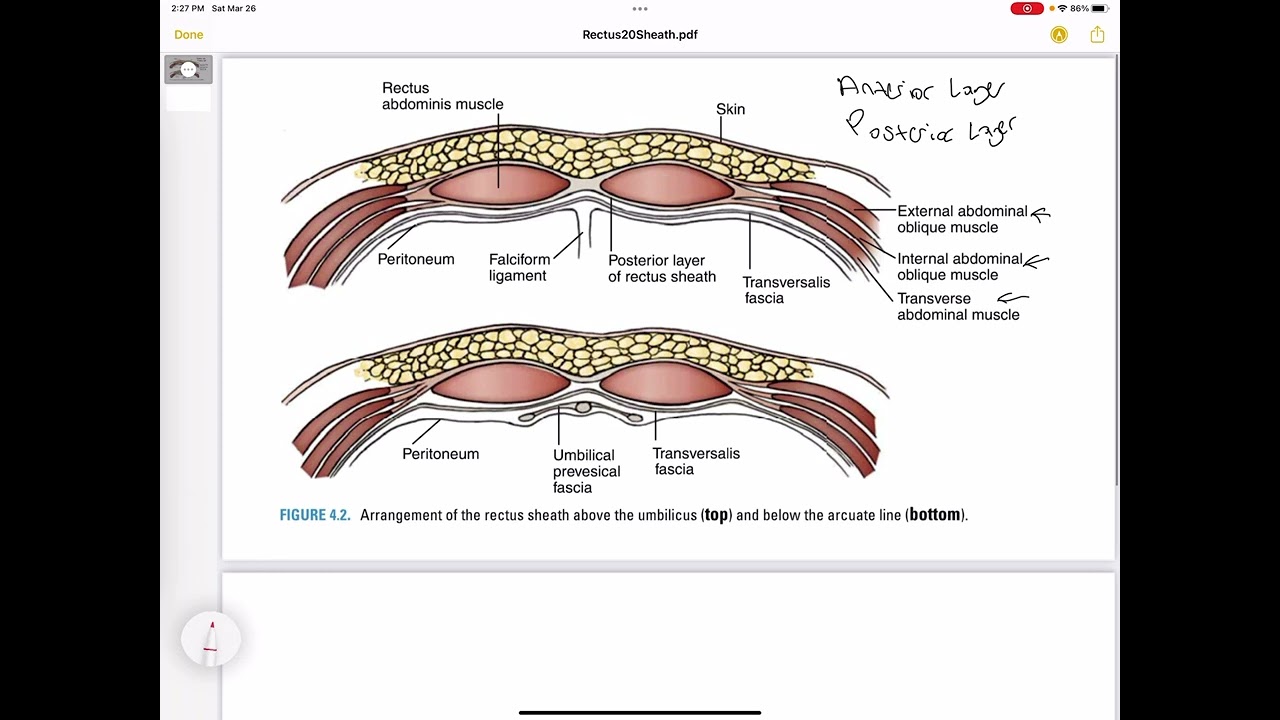 Rectus Sheath