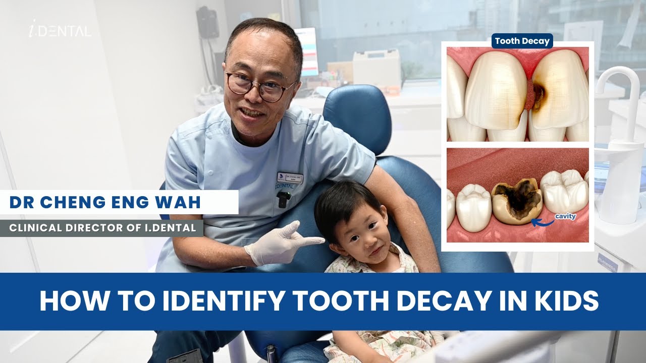 Tooth Decay In Kids: What Every Parent Should Know | i.Dental