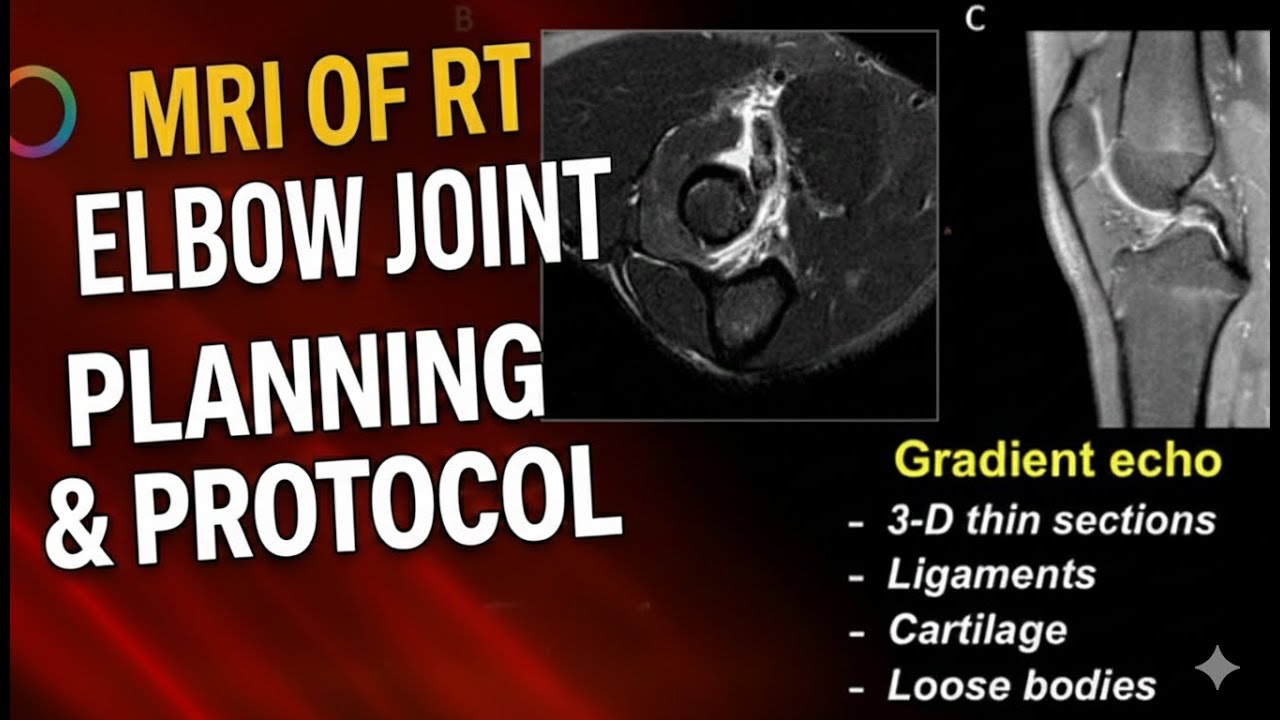 MRI of Right Elbow Joint Planning | Positioning & Protocol Explained