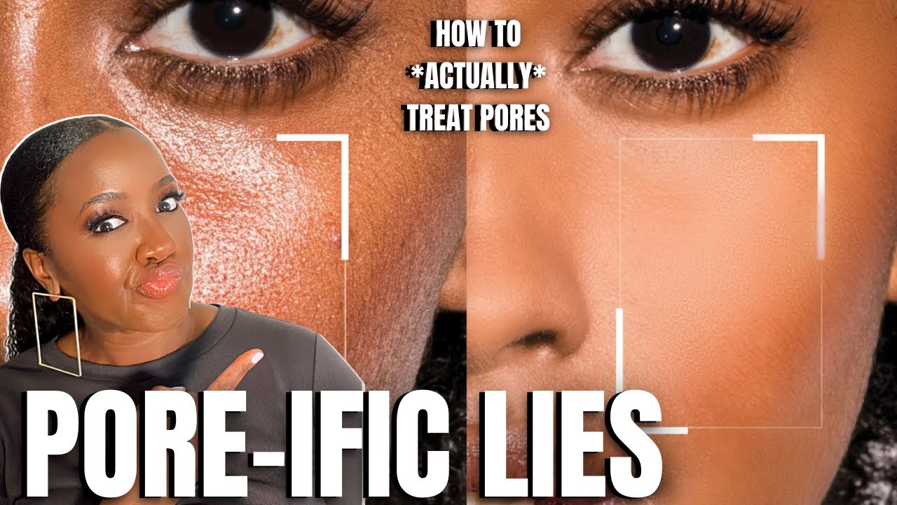 Actually, Do THIS to Treat Large Pores (Black Skin)