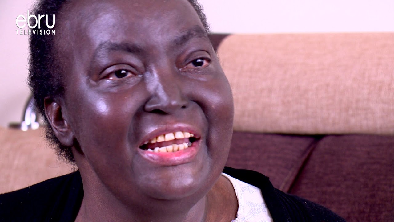 How I Survived Acute Leukemia: Dorothy Mulei's Story