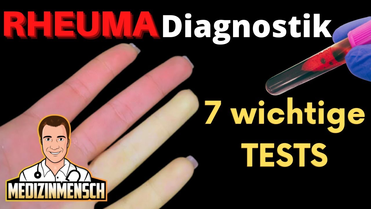 Rheumafaktor, HLA B27 und ACPA (Rheumatologe erklärt wichtigste Rheuma-Tests)