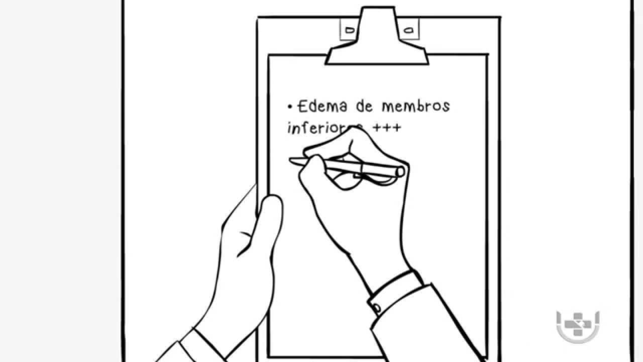 Caso Clínico