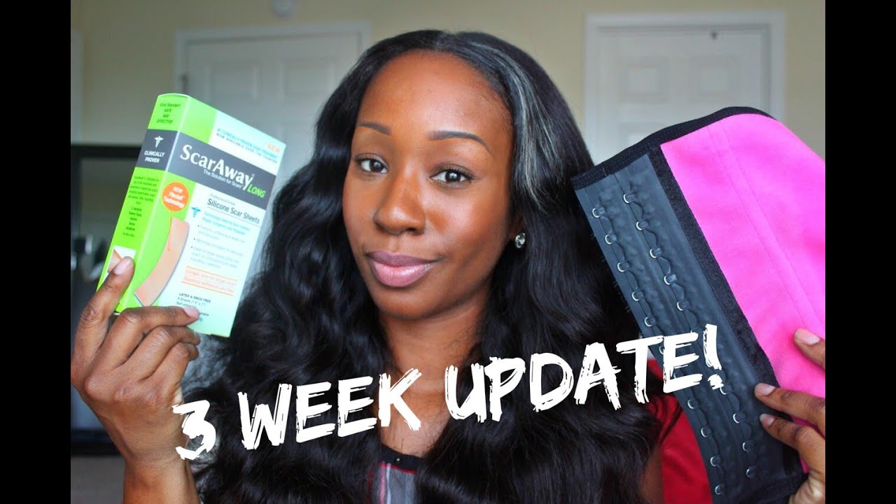 Tummy Tuck 3 Week Update | Work/Waist Trainers/Scar Away 6.25.15