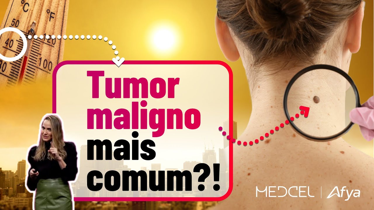 O que você PRECISA SABER sobre carcinoma basocelular da pele!