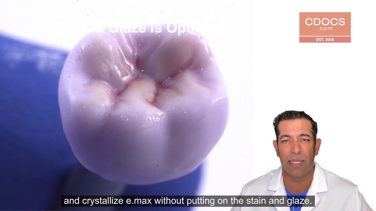 Tip of the Day: Self Glazing e.max