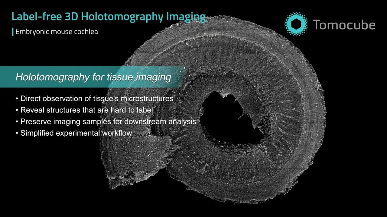 Embryonic mouse cochlea - Label-free 3D imaging by Holotomography