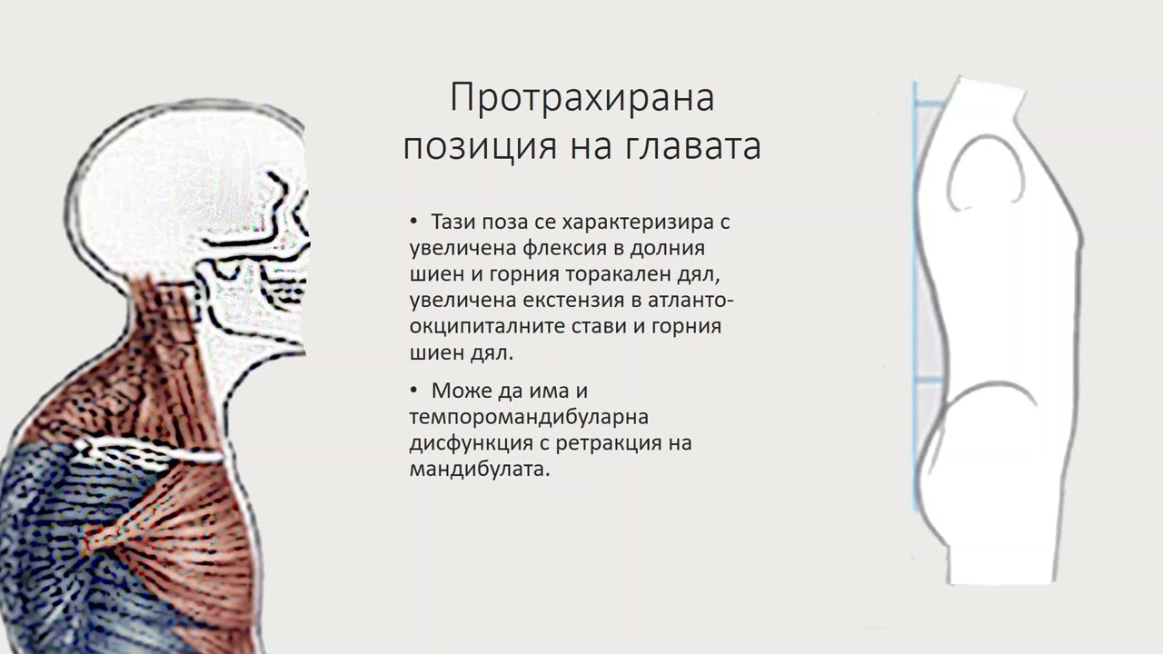 Съвременният начин на живот и функционалните гръбначни изкривявания