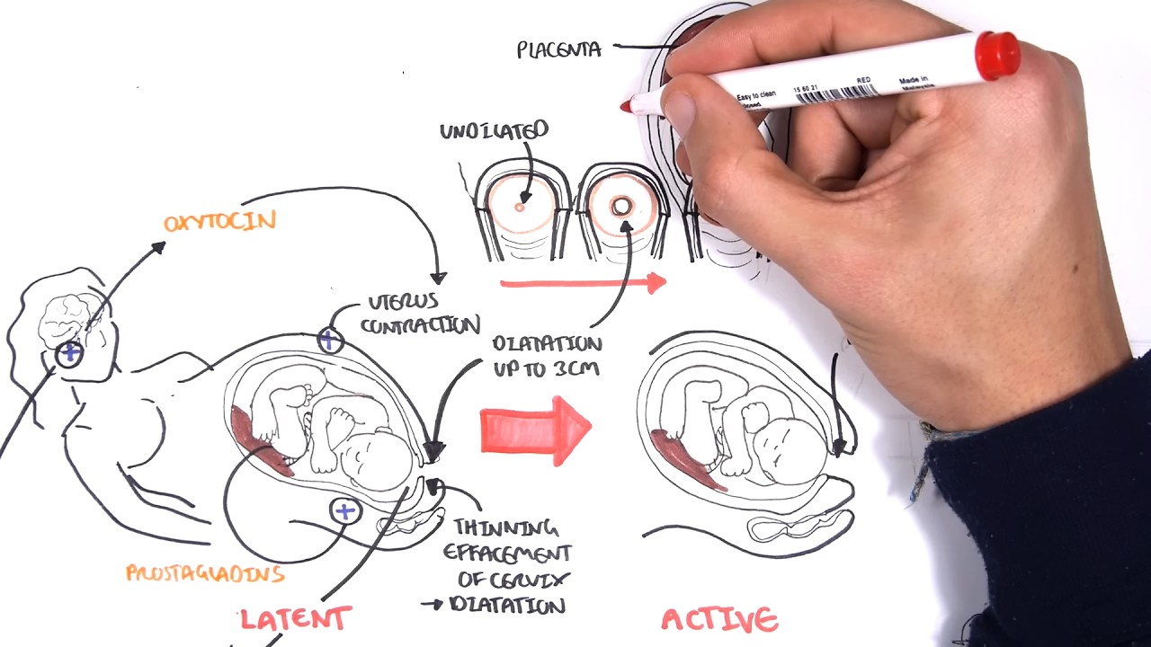 Obstetrics - Stages of Labour