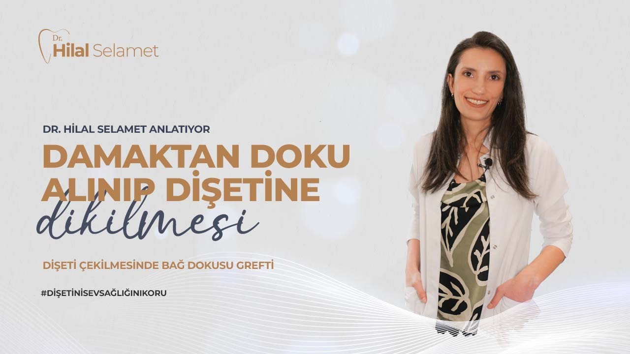 Diş eti Çekilmesinde Bağ Dokusu Grefti Tedavisi Nedir? I Damaktan Doku Alınıp Diş etine Dikilmesi