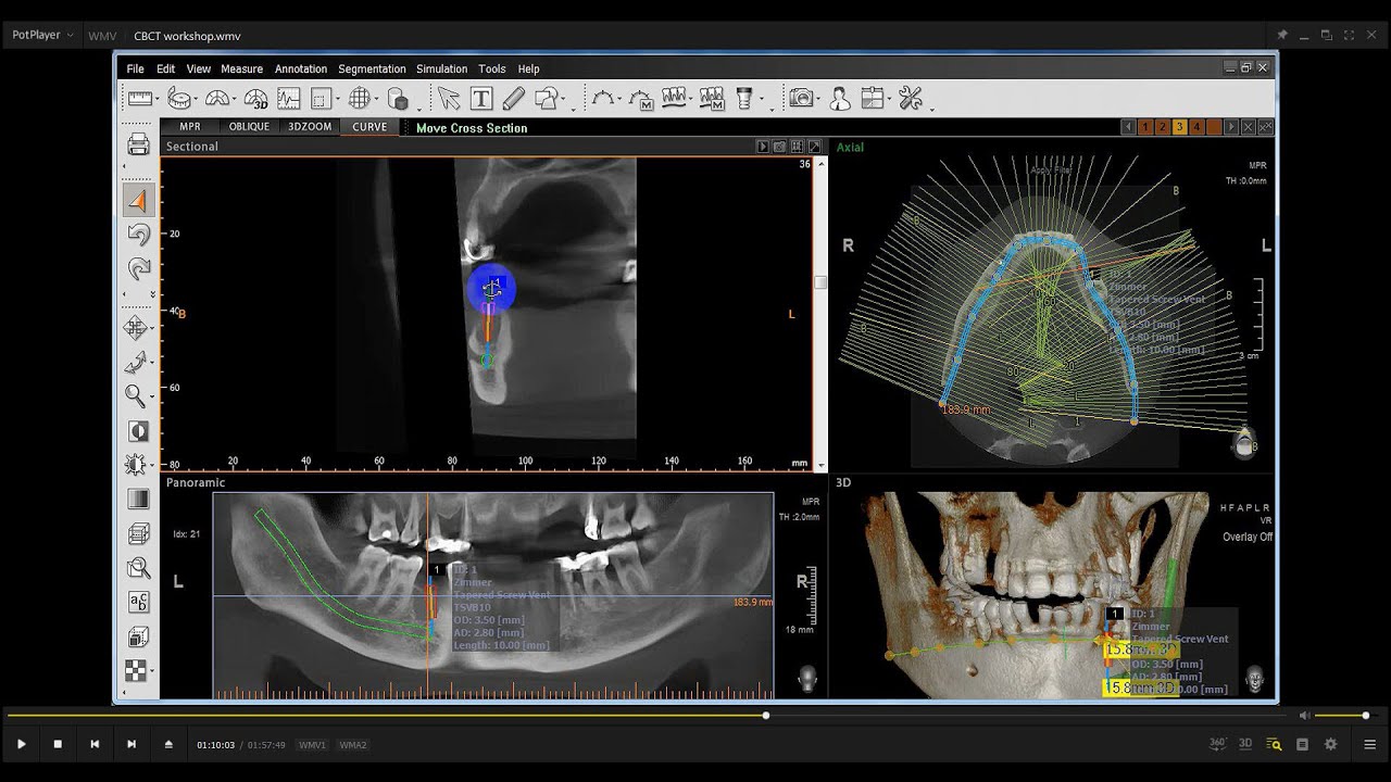 2- Cone beam CT (CBCT): The third eye in dentistry (Workshop)