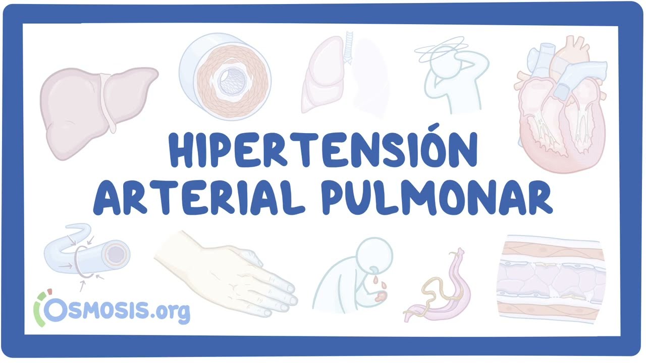 Hipertensi&oacute;n Arterial Pulmonar (NORD)