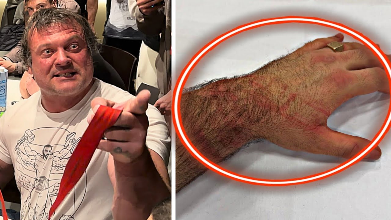DEVON LARRATT D*STROYED VITALY'S HAND...