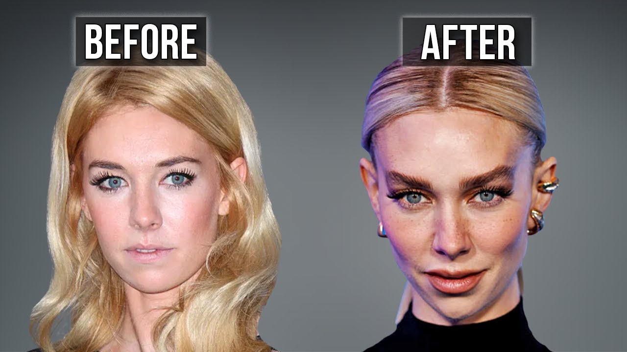 About Vanessa Kirby's Plastic Surgery; You Were All Right… I’m Shook”