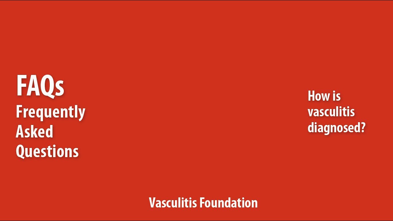 Vasculitis FAQ: How is vasculitis diagnosed?