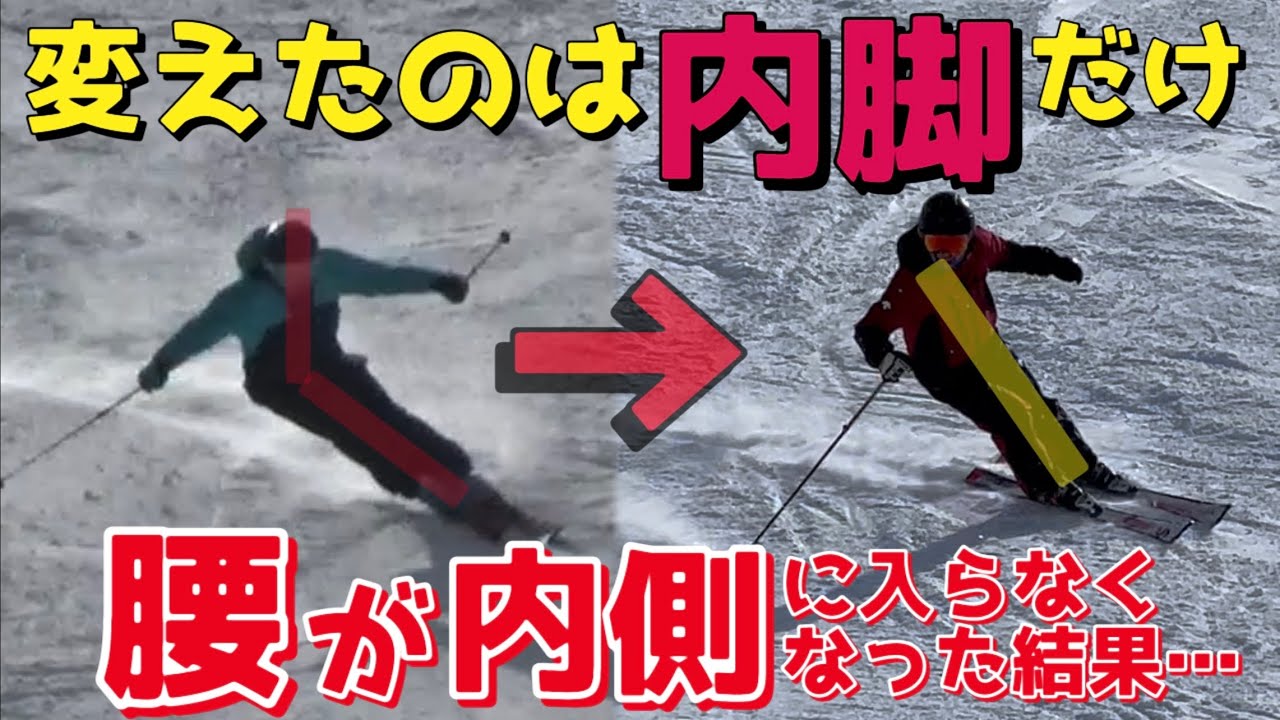 【スキー】内脚突っ張っていて外足踏めなかったのが改善！綺麗に内傾軸ができない人へおすすめ