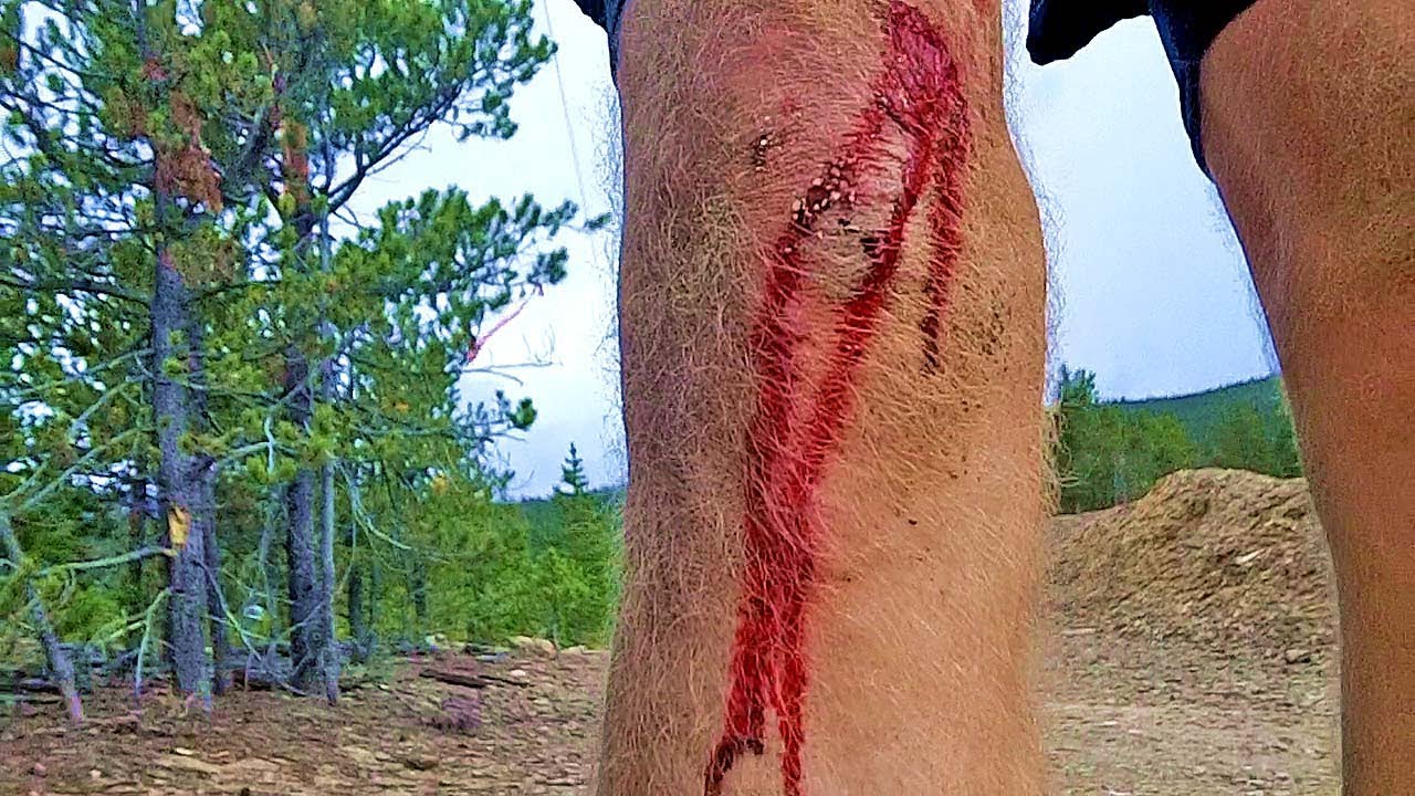 Leadville 100: There Will Be Blood. And Llamas. Again.