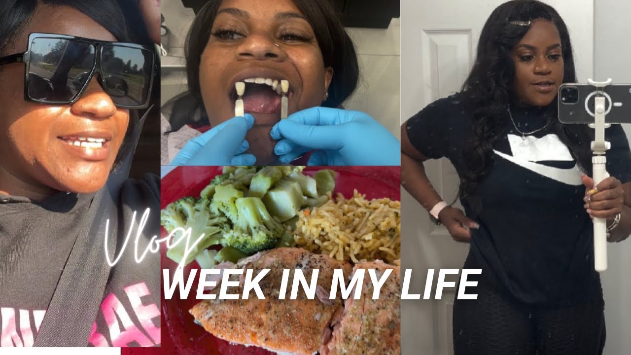 Vlog: Week In My Life | Recovery Mode, Lipo Shots, Sephora Haul, New Teeth… Eventful Week!